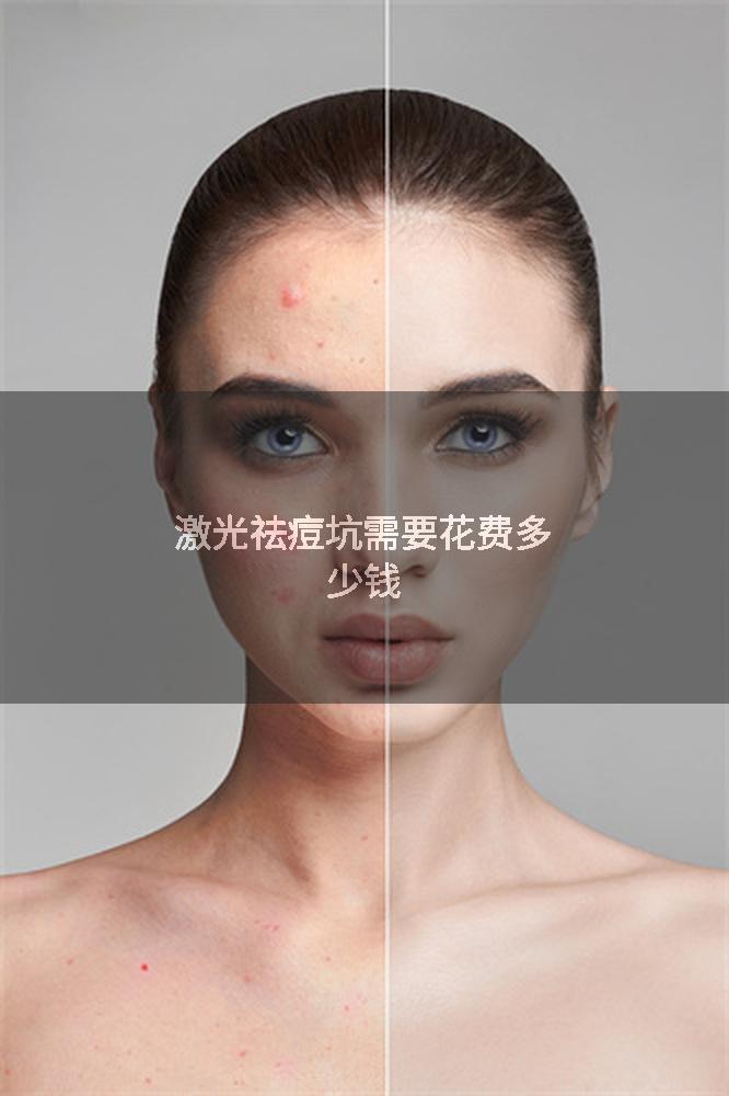 激光祛痘坑需要花费多少钱