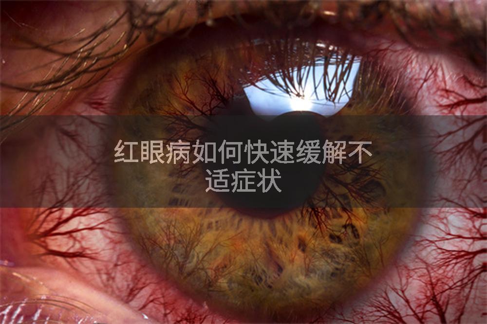 红眼病如何快速缓解不适症状