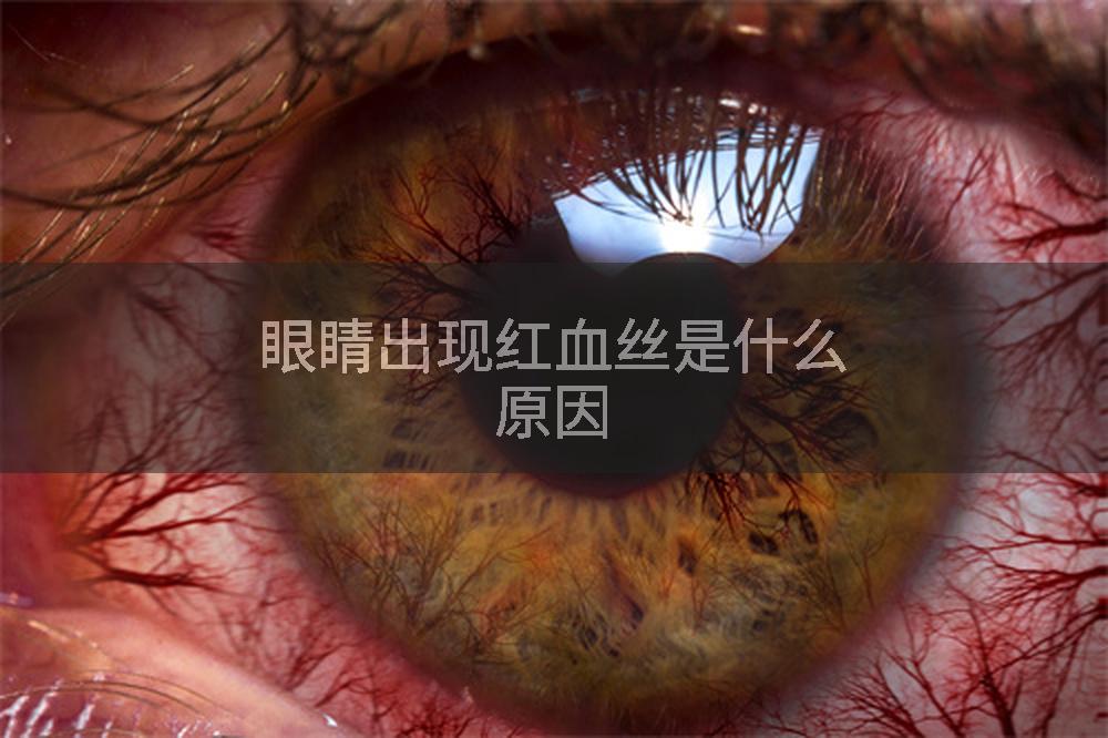 眼睛出现红血丝是什么原因