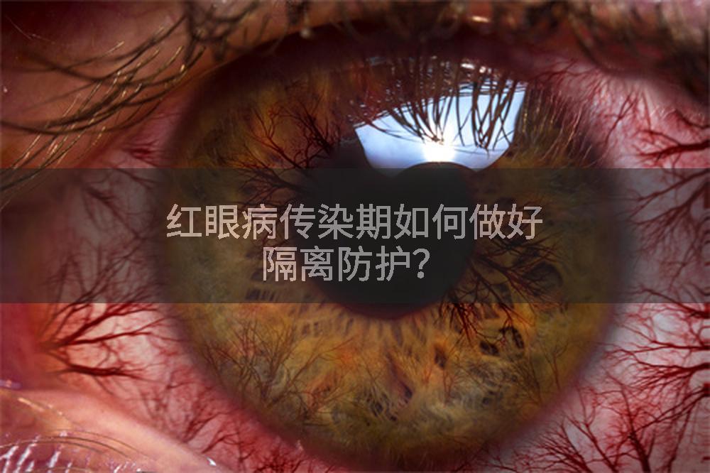 红眼病传染期如何做好隔离防护？