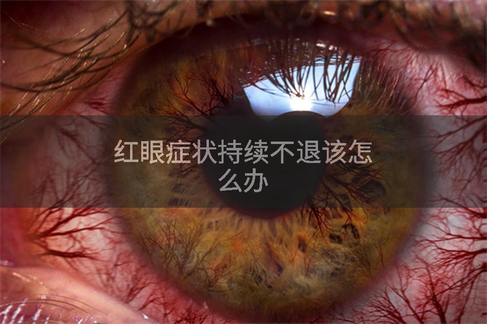 红眼症状持续不退该怎么办