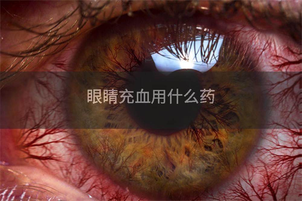 眼睛充血用什么药