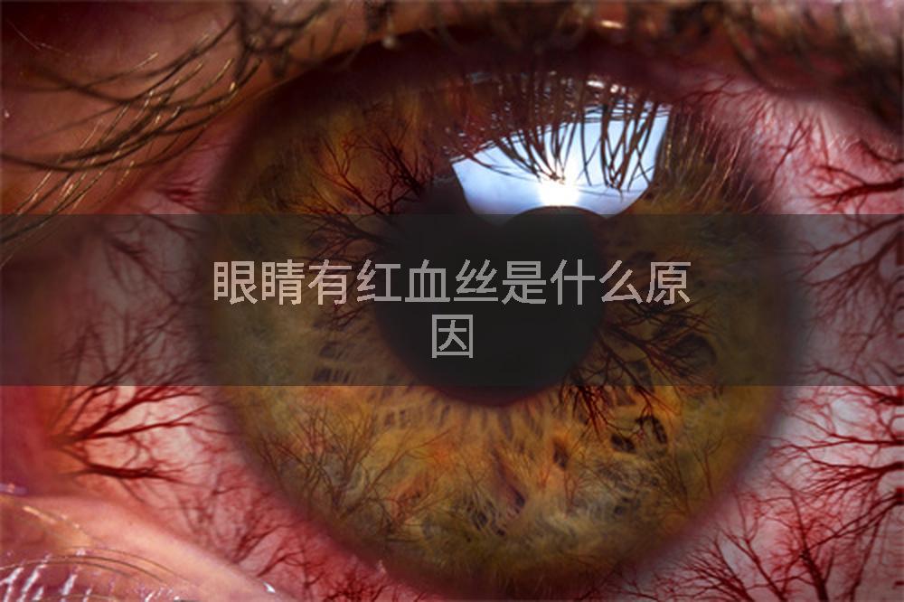 眼睛有红血丝是什么原因