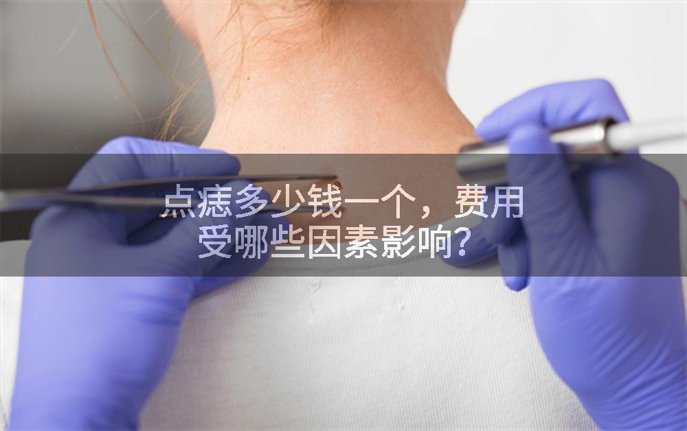 点痣多少钱一个，费用受哪些因素影响？