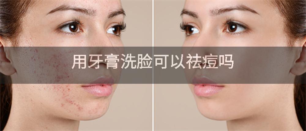 用牙膏洗脸可以祛痘吗