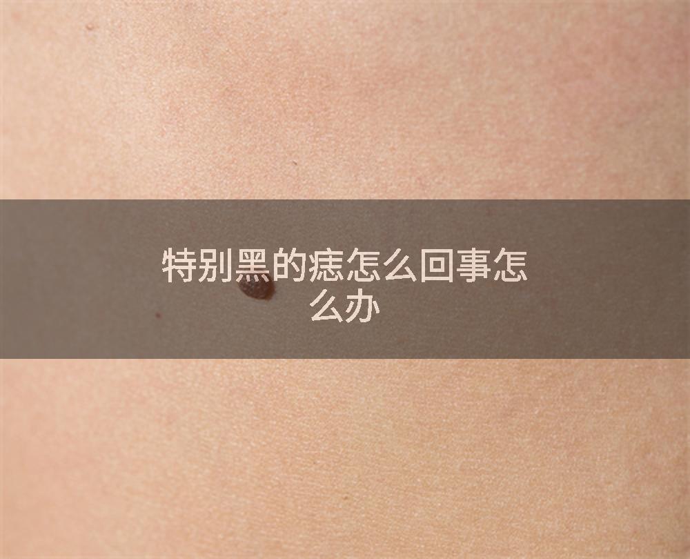 特别黑的痣怎么回事怎么办