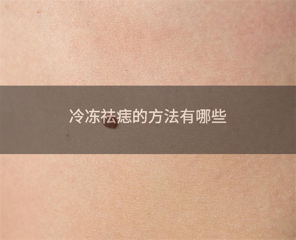 冷冻祛痣的方法有哪些