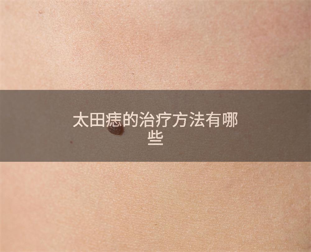 太田痣的治疗方法有哪些