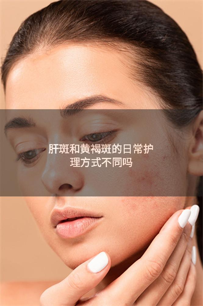 肝斑和黄褐斑的日常护理方式不同吗