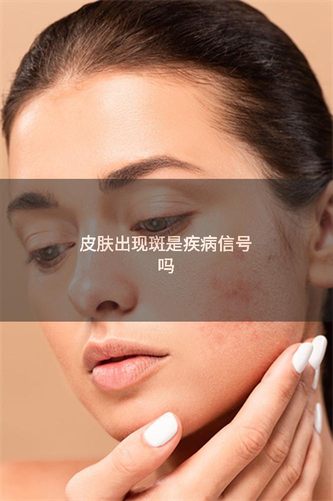 皮肤出现斑是疾病信号吗