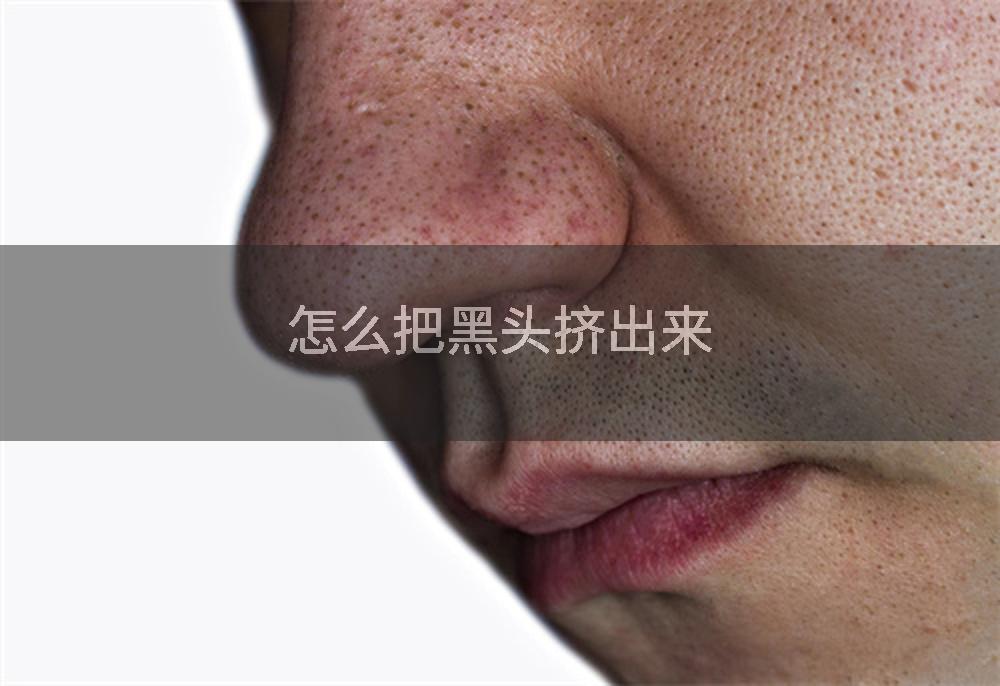 怎么把黑头挤出来