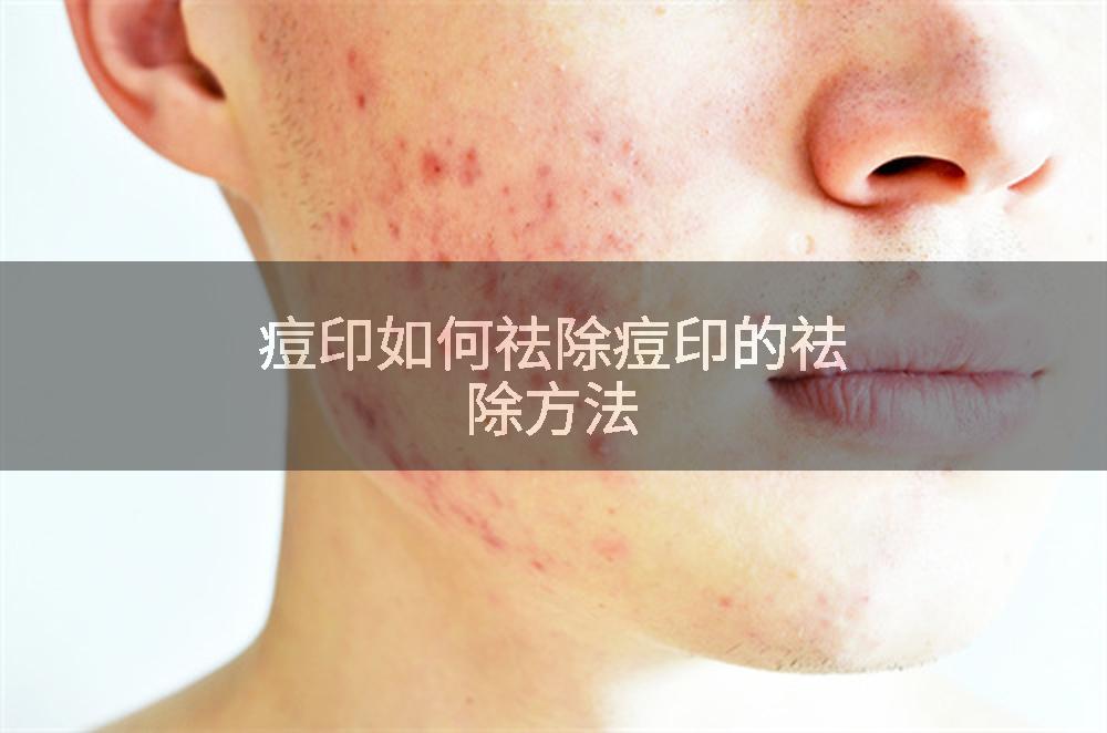 痘印如何祛除痘印的祛除方法