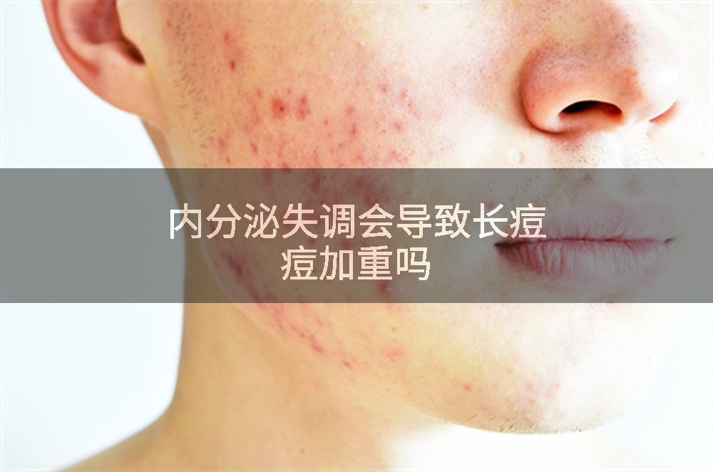 内分泌失调会导致长痘痘加重吗