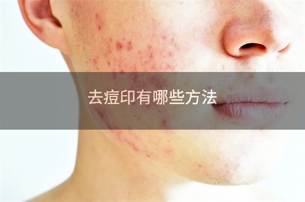 去痘印有哪些方法
