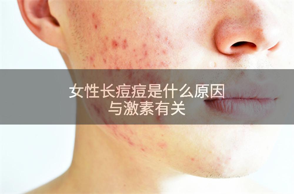 女性长痘痘是什么原因与激素有关