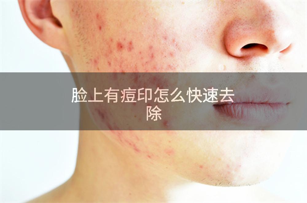 脸上有痘印怎么快速去除
