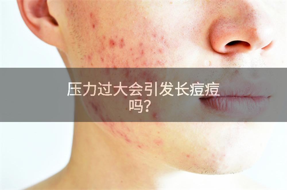 压力过大会引发长痘痘吗？