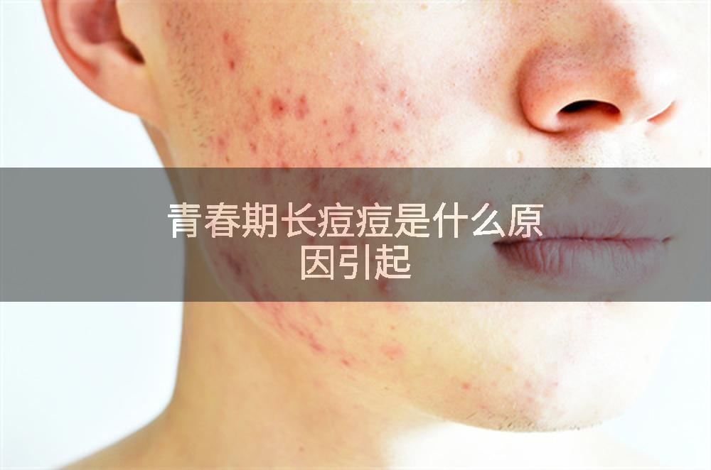 青春期长痘痘是什么原因引起