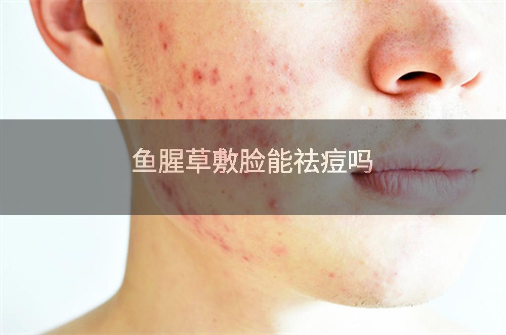 鱼腥草敷脸能祛痘吗