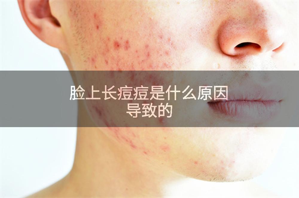 脸上长痘痘是什么原因导致的