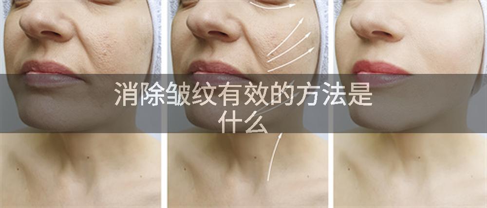 消除皱纹有效的方法是什么