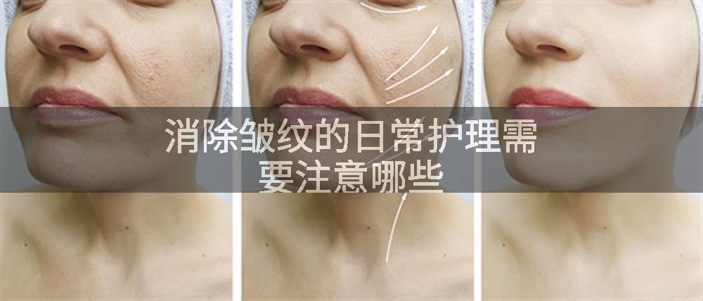 消除皱纹的日常护理需要注意哪些