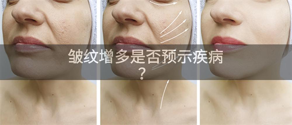 皱纹增多是否预示疾病？