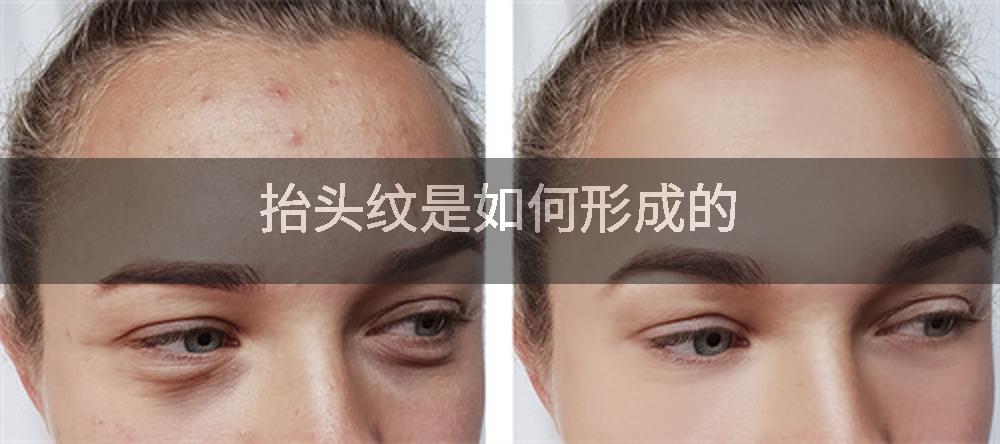 抬头纹是如何形成的