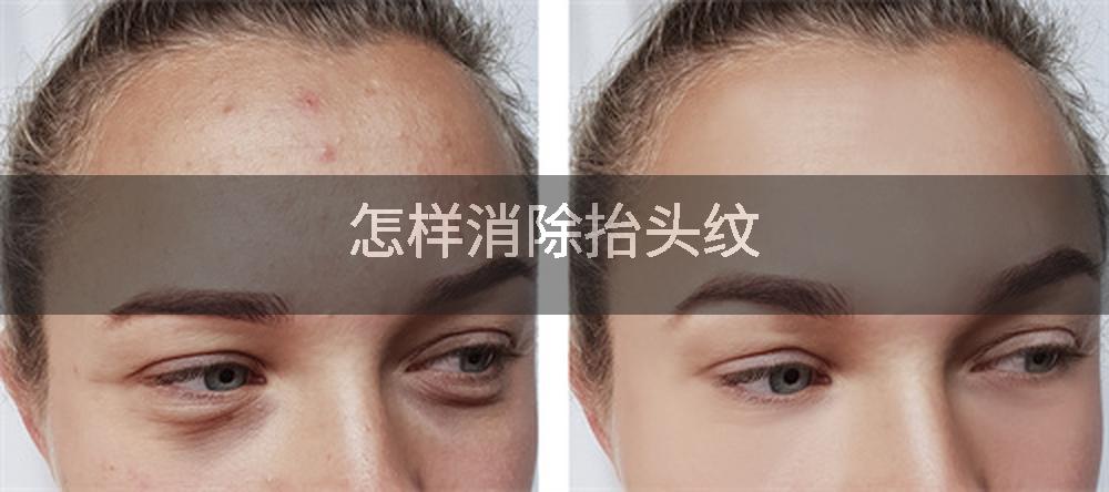 怎样消除抬头纹