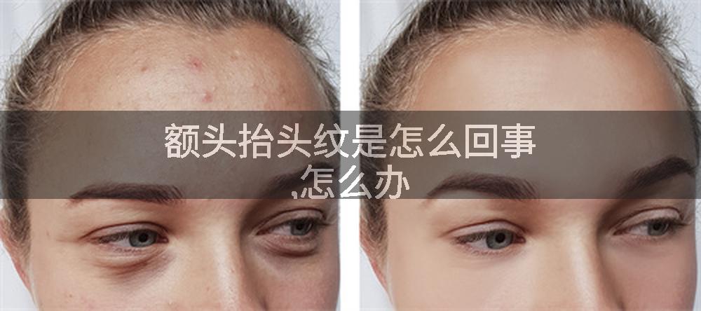 额头抬头纹是怎么回事,怎么办