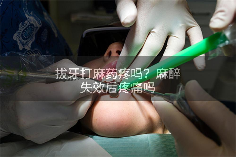 拔牙打麻药疼吗？麻醉失效后疼痛吗