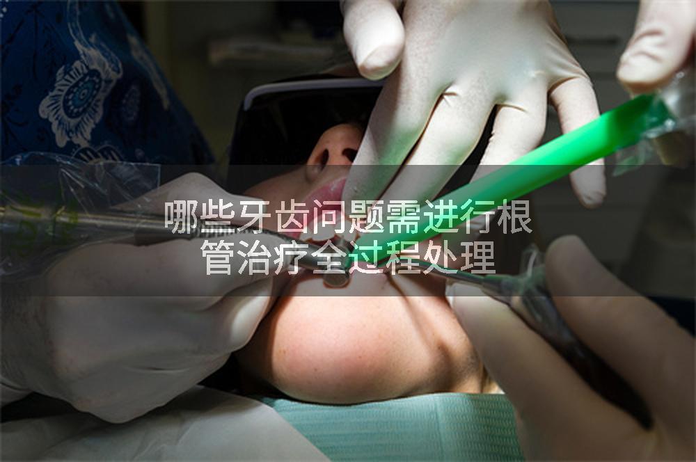 哪些牙齿问题需进行根管治疗全过程处理