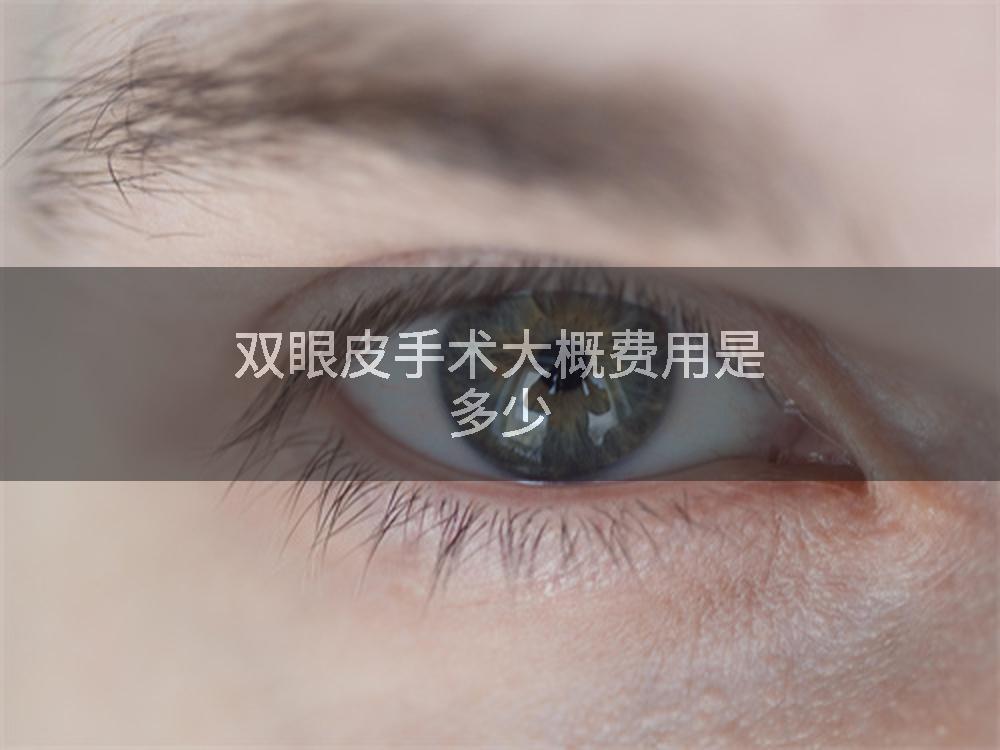 双眼皮手术大概费用是多少