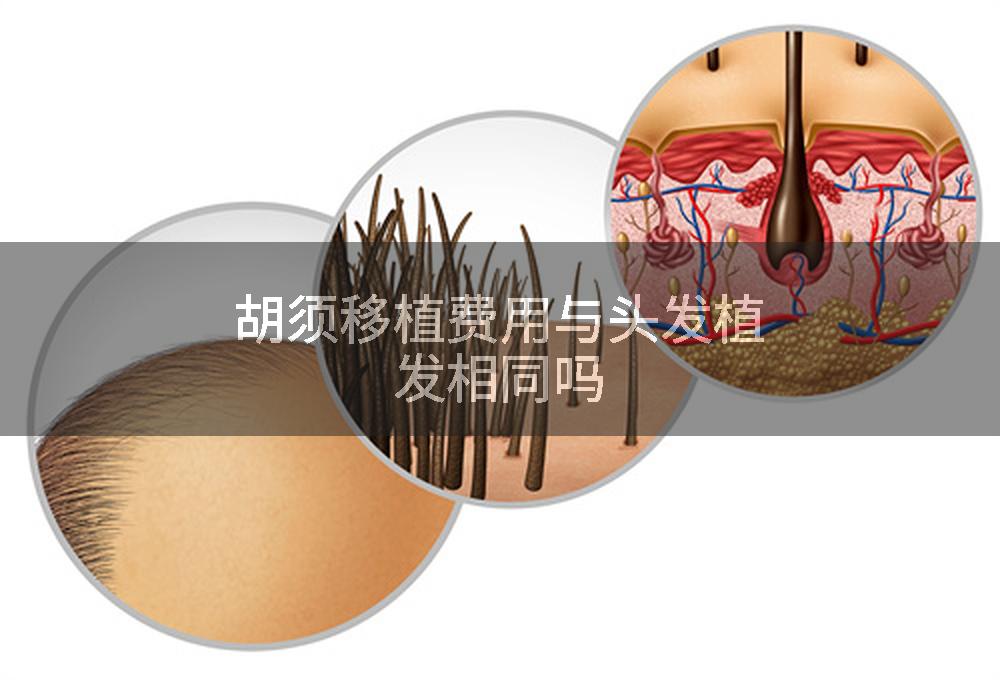 胡须移植费用与头发植发相同吗