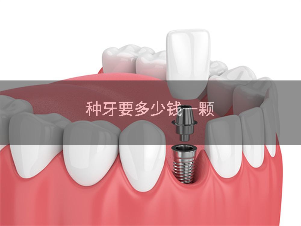 种牙要多少钱一颗