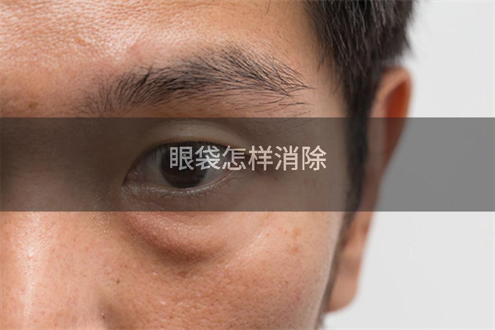 眼袋怎样消除