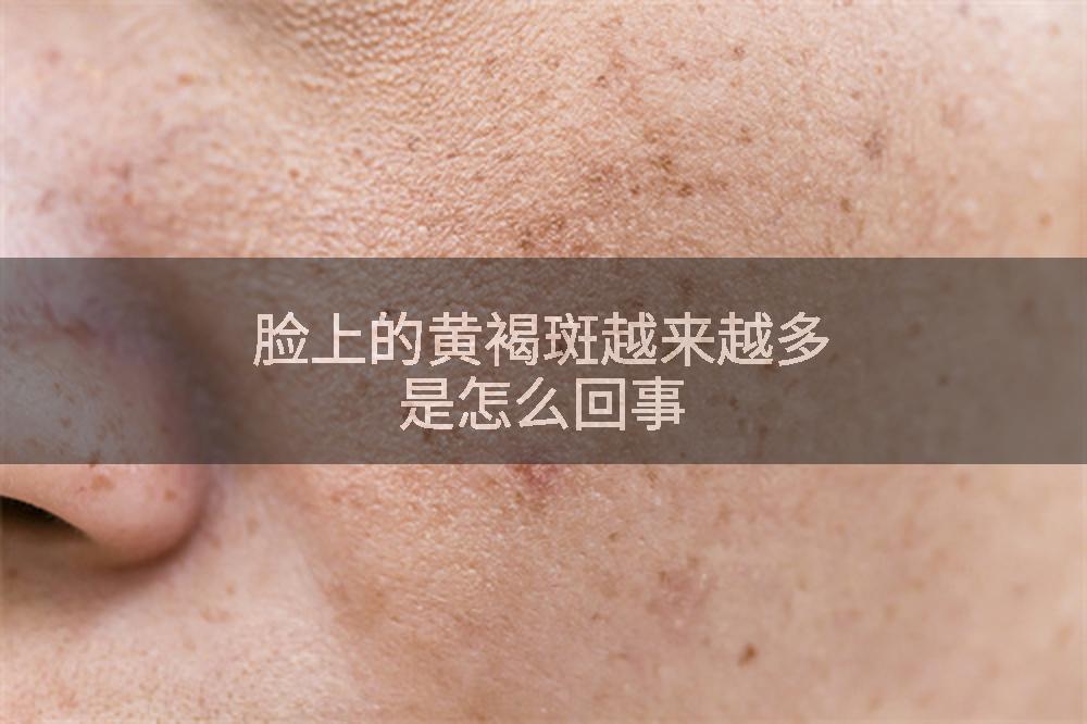 脸上的黄褐斑越来越多是怎么回事