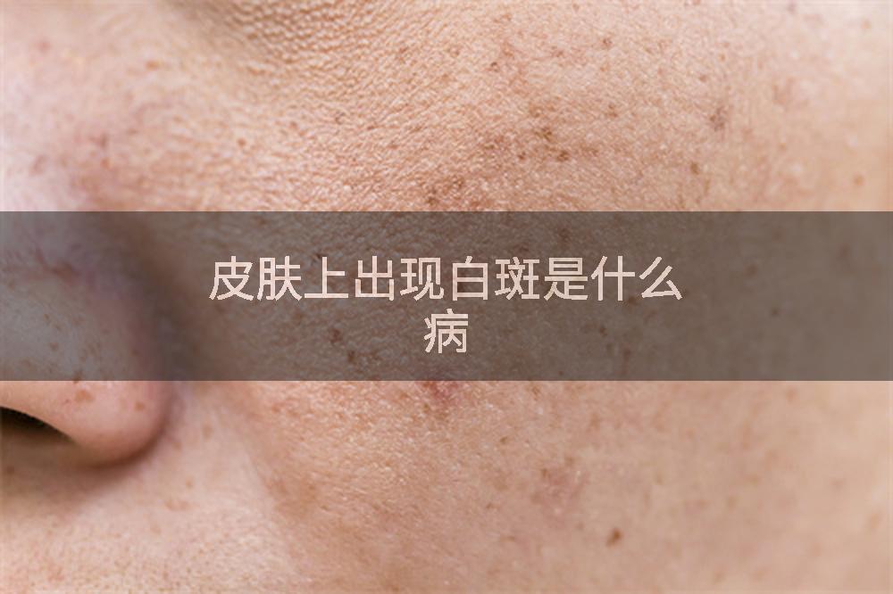 皮肤上出现白斑是什么病