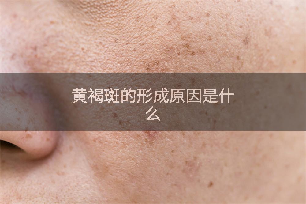 黄褐斑的形成原因是什么
