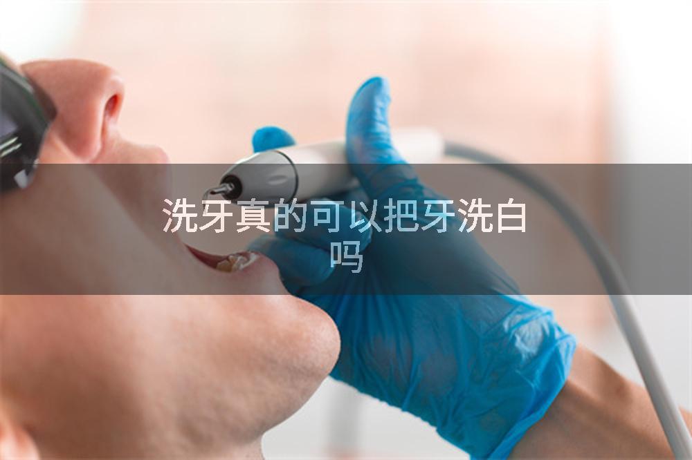 洗牙真的可以把牙洗白吗