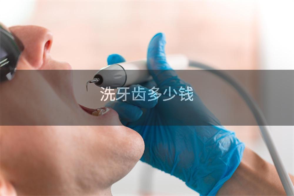 洗牙齿多少钱