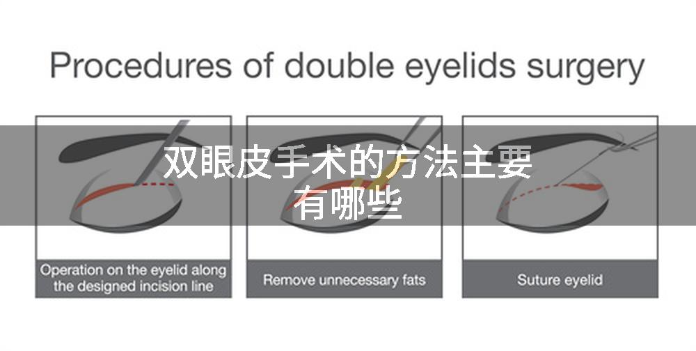 双眼皮手术的方法主要有哪些