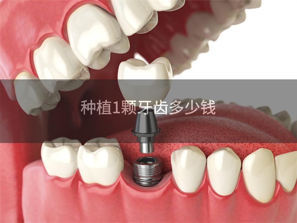 种植1颗牙齿多少钱