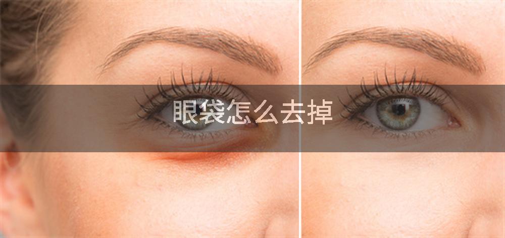 眼袋怎么去掉