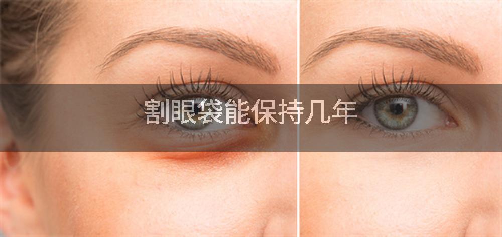 割眼袋能保持几年