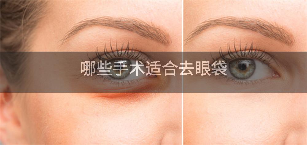 哪些手术适合去眼袋