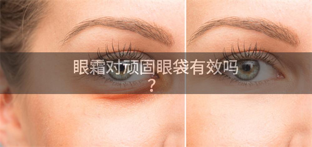 眼霜对顽固眼袋有效吗？