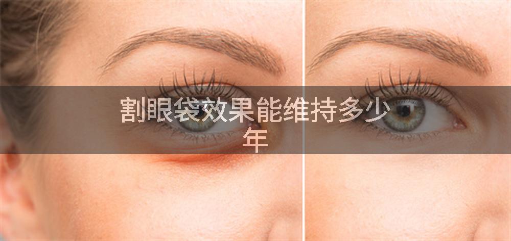 割眼袋效果能维持多少年
