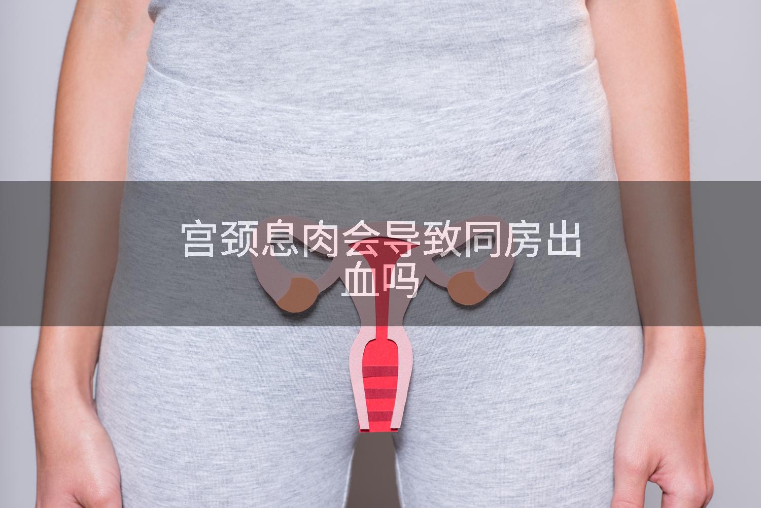 宫颈息肉会导致同房出血吗