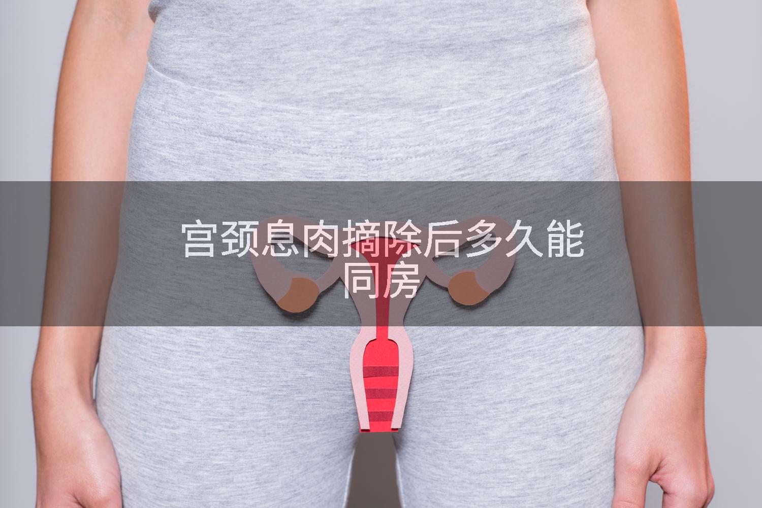 宫颈息肉摘除后多久能同房